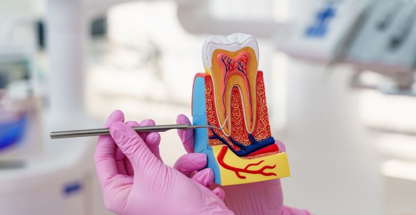 Endodonta pokazujący pacjentowi model zęba przed leczeniem kanałowym