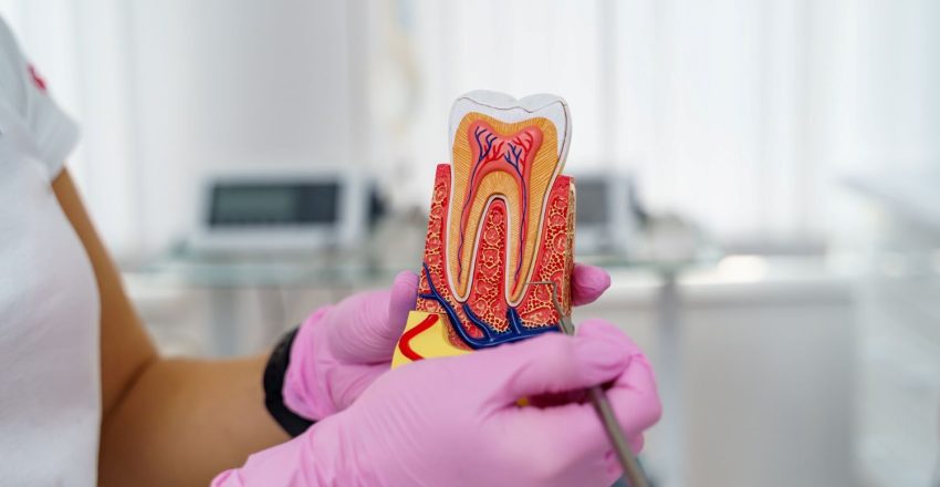 Dentysta wyjaśniający, jak przebiega leczenie kanałowe zęba