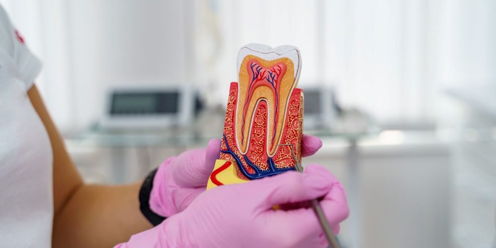 Dentysta wyjaśniający, jak przebiega leczenie kanałowe zęba